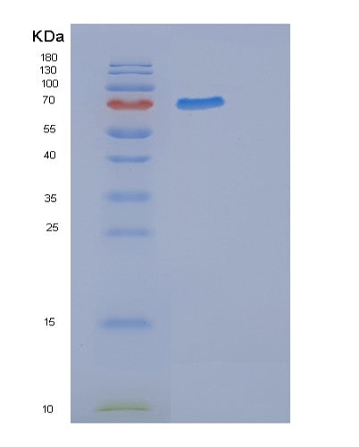 Human ERBB2 (Receptor Tyrosine-Protein Kinase Erbb-2) - Recombinant Protein
