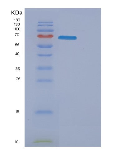 Mouse Erbb3 (Receptor Tyrosine-Protein Kinase Erbb-3) - Recombinant Protein