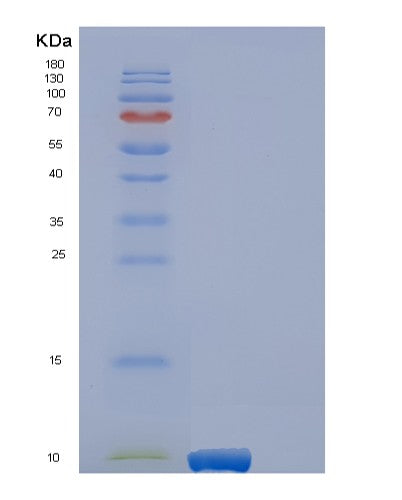 Human EREG (Proepiregulin) - Recombinant Protein