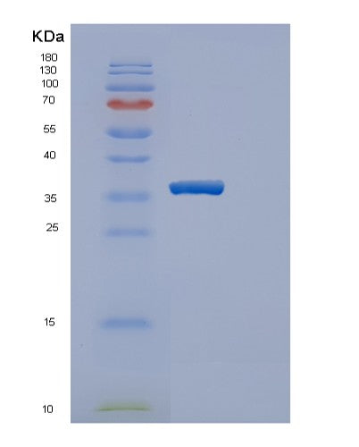 Human SULT1E1 (Sulfotransferase 1E1) - Recombinant Protein