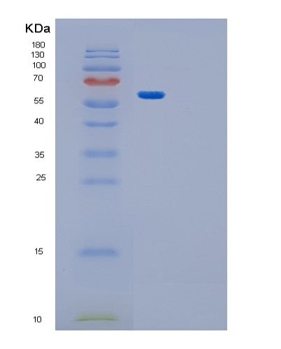 Human GPT2 (Alanine Aminotransferase 2) - Recombinant Protein