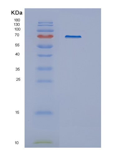 Human GUSB (Beta-Glucuronidase) - Recombinant Protein
