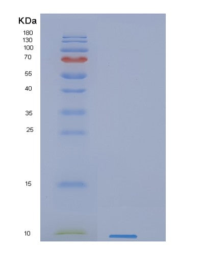 Human GYPC (Glycophorin-C) - Recombinant Protein