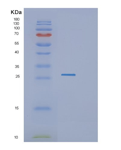Human GZMH (Granzyme H) - Recombinant Protein