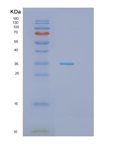 Human HAUS1 (Haus Augmin-Like Complex Subunit 1) - Recombinant Protein