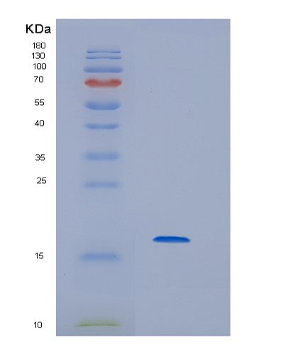 Human HBG2 (Hemoglobin Subunit Gamma-2) - Recombinant Protein