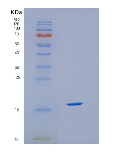 Human HBZ (Hemoglobin Subunit Zeta) - Recombinant Protein