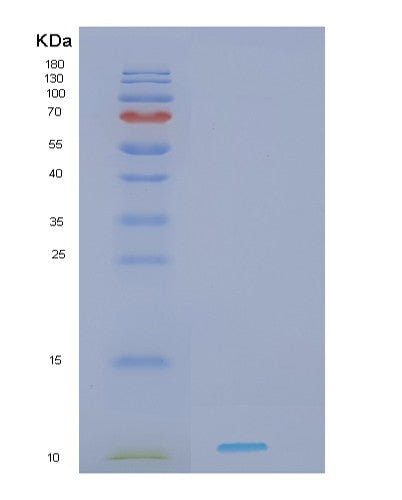Human HDGF (Hepatoma-Derived Growth Factor) - Recombinant Protein