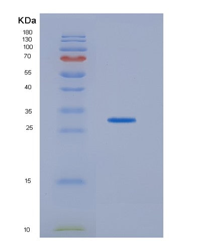 Human HDHD2 (Haloacid Dehalogenase-Like Hydrolase Domain-Containing Protein 2) - Recombinant Protein