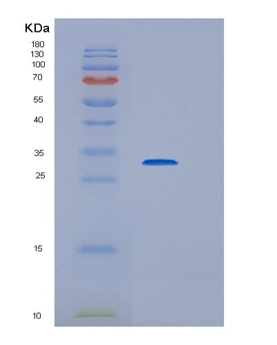 Human HDHD3 (Haloacid Dehalogenase-Like Hydrolase Domain-Containing Protein 3) - Recombinant Protein