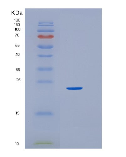 Human HEBP1 (Heme-Binding Protein 1) - Recombinant Protein
