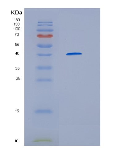 Human HERC5 (E3 Isg15--Protein Ligase Herc5) - Recombinant Protein