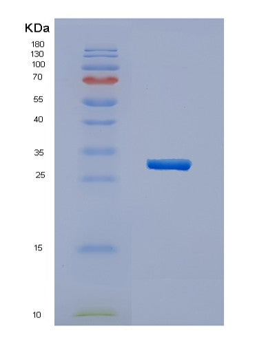 Human HERPUD1 (Homocysteine-Responsive Endoplasmic Reticulum-Resident Ubiquitin-Like Domain Member 1 Protein) - Recombinant Protein