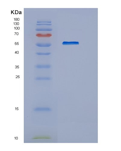 Human HEXA (Beta-Hexosaminidase Subunit Alpha) - Recombinant Protein