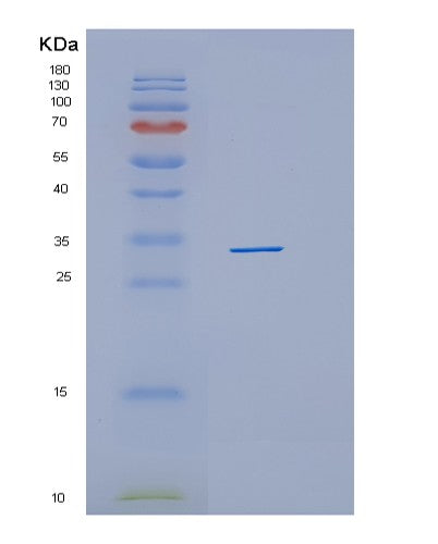 Human HHEX (Hematopoietically-Expressed Homeobox Protein Hhex) - Recombinant Protein