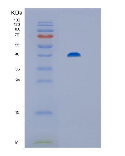 Human ST13 (Hsc70-Interacting Protein) - Recombinant Protein