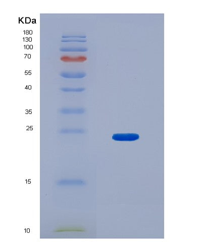 Human JPT1 (Jupiter Microtubule Associated Homolog 1) - Recombinant Protein