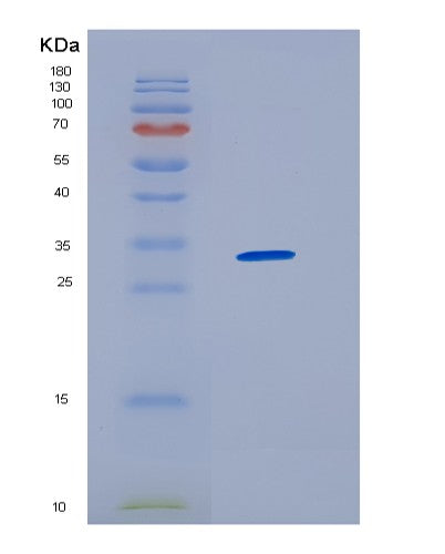 Human HNRNPAB (Heterogeneous Nuclear Ribonucleoprotein A/B) - Recombinant Protein