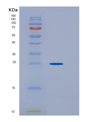 Human HPGDS (Hematopoietic Prostaglandin D Synthase) - Recombinant Protein