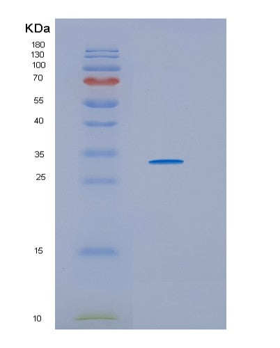 Human HSD17B11 (Estradiol 17-Beta-Dehydrogenase 11) - Recombinant Protein