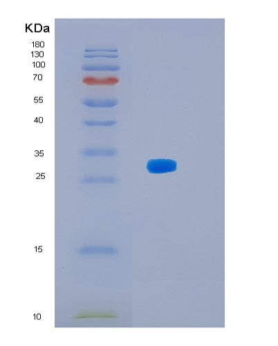 Human HSD17B8 ((3R)-3-Hydroxyacyl-Coa Dehydrogenase) - Recombinant Protein