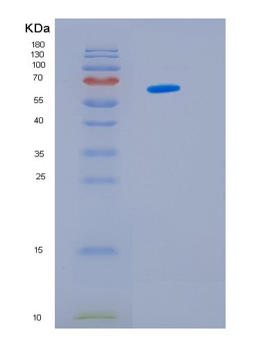 Human HSPD1 (60 Kda Heat Shock Protein, Mitochondrial) - Recombinant Protein
