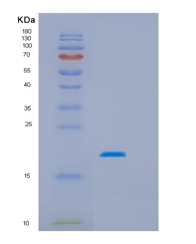 Human HSPB3 (Heat Shock Protein Beta-3) - Recombinant Protein