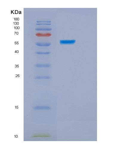 Human HSPBAP1 (Hspb1-Associated Protein 1) - Recombinant Protein