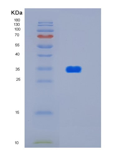 Human HTRA2 (Serine Protease Htra2, Mitochondrial) - Recombinant Protein
