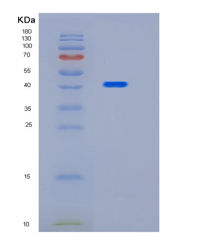 Human HYKK (Hydroxylysine Kinase) - Recombinant Protein
