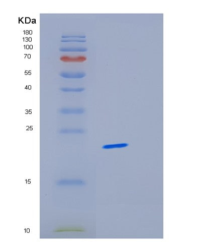 Human MRPL58 (Large Ribosomal Subunit Protein Ml62) - Recombinant Protein
