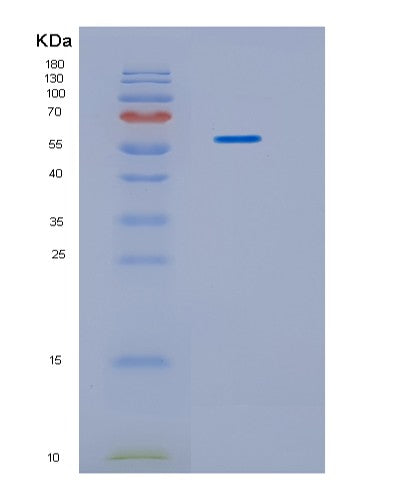 Human IDS (Iduronate 2-Sulfatase) - Recombinant Protein