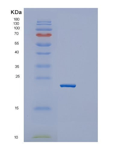 Mouse Igfbp6 (Insulin-Like Growth Factor-Binding Protein 6) - Recombinant Protein