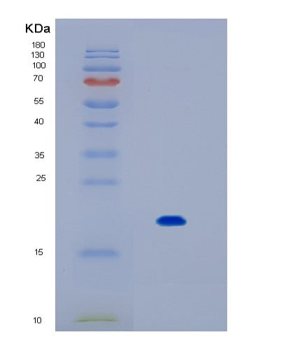 Human IL17B (Interleukin-17B) - Recombinant Protein