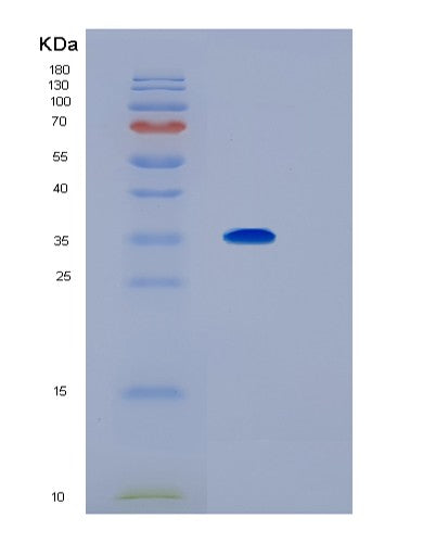Human IL1RL1 (Interleukin-1 Receptor-Like 1) - Recombinant Protein