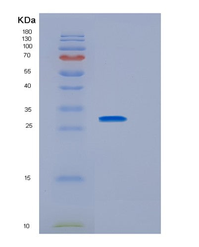 Human IL2RG (Cytokine Receptor Common Subunit Gamma) - Recombinant Protein