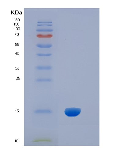 Human IL5 (Interleukin-5) - Recombinant Protein
