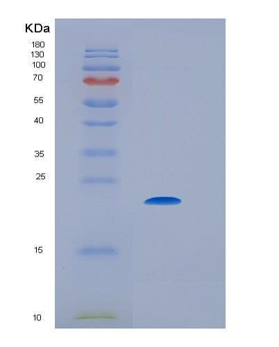 Mouse Il6 (Interleukin-6) - Recombinant Protein