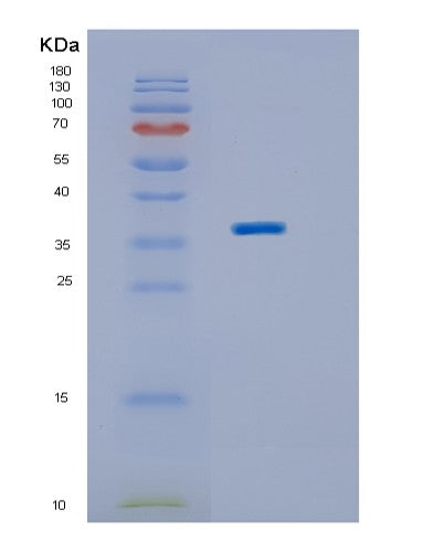 Human BPNT2 (Golgi-Resident Adenosine 3',5'-Bisphosphate 3'-Phosphatase) - Recombinant Protein