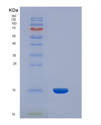 Human INHBA (Inhibin Beta A Chain) - Recombinant Protein