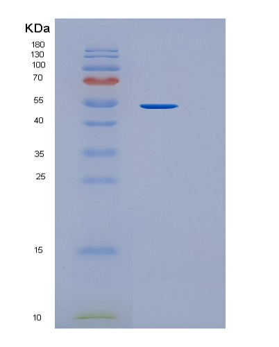Mouse Icam1 (Intercellular Adhesion Molecule 1) - Recombinant Protein