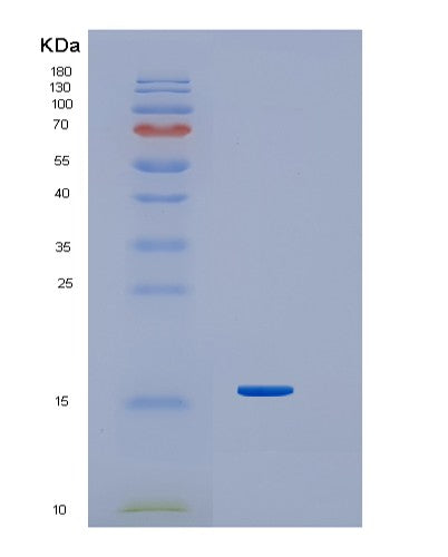 Human IFNG (Interferon Gamma) - Recombinant Protein