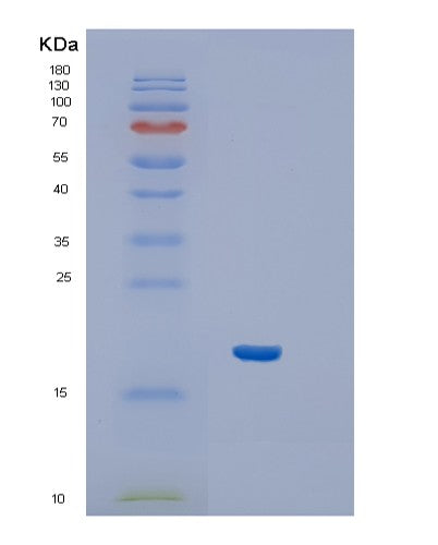 Human IFNA1 (Interferon Alpha-1/13) - Recombinant Protein