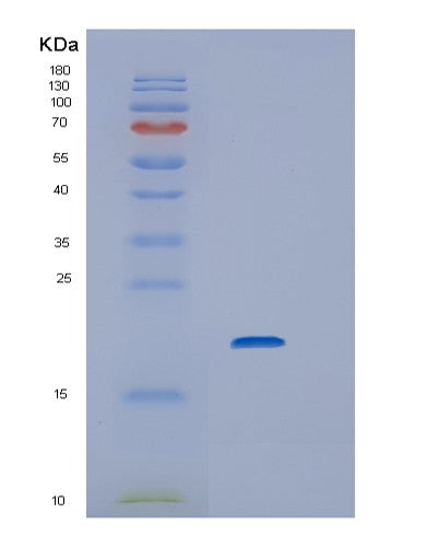 Human IL6 (Interleukin-6) - Recombinant Protein