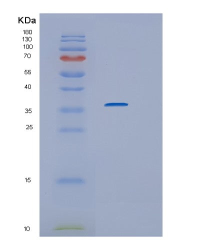Human IL1R1 (Interleukin-1 Receptor Type 1) - Recombinant Protein