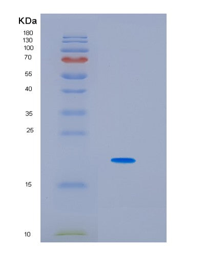 Human IL6 (Interleukin-6) - Recombinant Protein