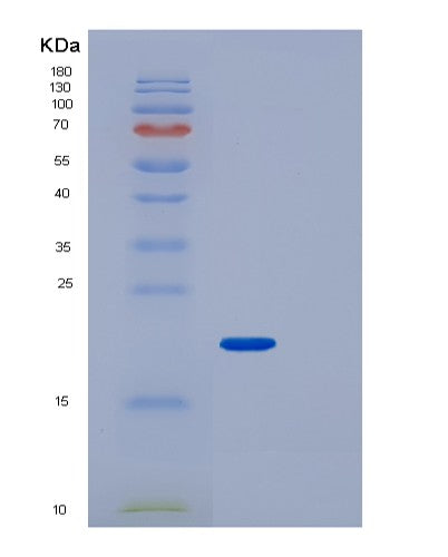 Human PPP1R1A (Protein Phosphatase 1 Regulatory Subunit 1A) - Recombinant Protein