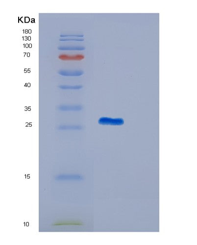 Human NMRK2 (Nicotinamide Riboside Kinase 2) - Recombinant Protein