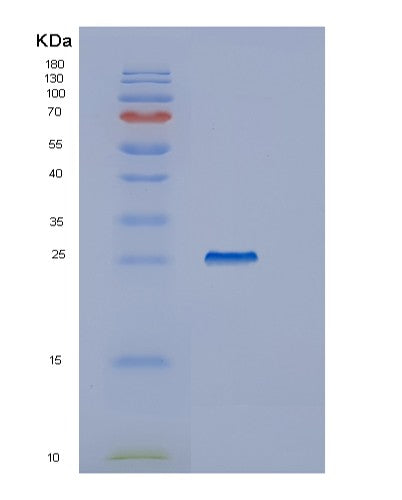 Human IYD (Iodotyrosine Deiodinase 1) - Recombinant Protein