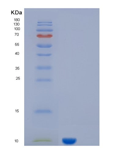 Human KAAG1 (Kidney-Associated Antigen 1) - Recombinant Protein